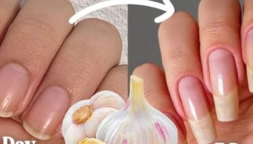 At 47, she does this with garlic twice a day: “I never thought my nails would…” At 47, she does this with garlic twice a day: “I never thought my nails would…”