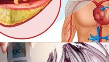 beetroot blood sugar Diabetes Management ginger red onion recipe Glucose Levels Healthy Recipes natural remedies Quick Meals 