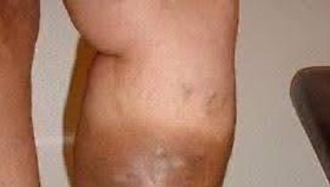 Advocate Health and fatigue Body Signals Brain Fog cardiac wellness citrus sleep benefits 