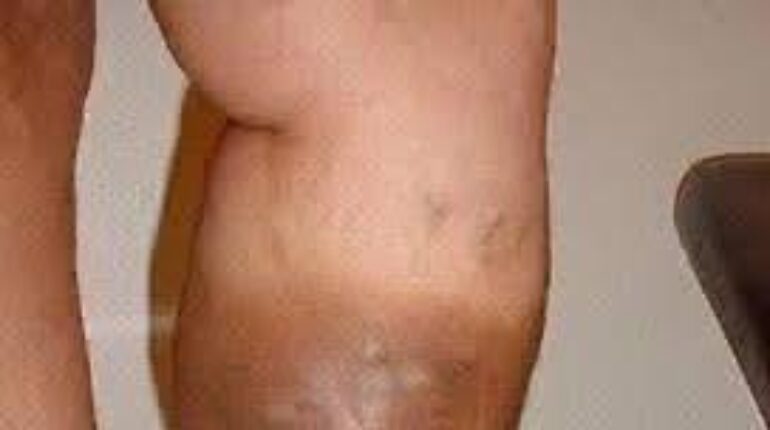 Advocate Health and fatigue Body Signals Brain Fog cardiac wellness citrus sleep benefits 