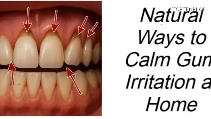 Image d'illustration © TopTenPlay EN