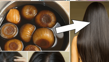 The Smelly Hair Oil That Dermatologists Won’t Stop Recommending (And Why It Actually Works) The Smelly Hair Oil That Dermatologists Won’t Stop Recommending (And Why It Actually Works)