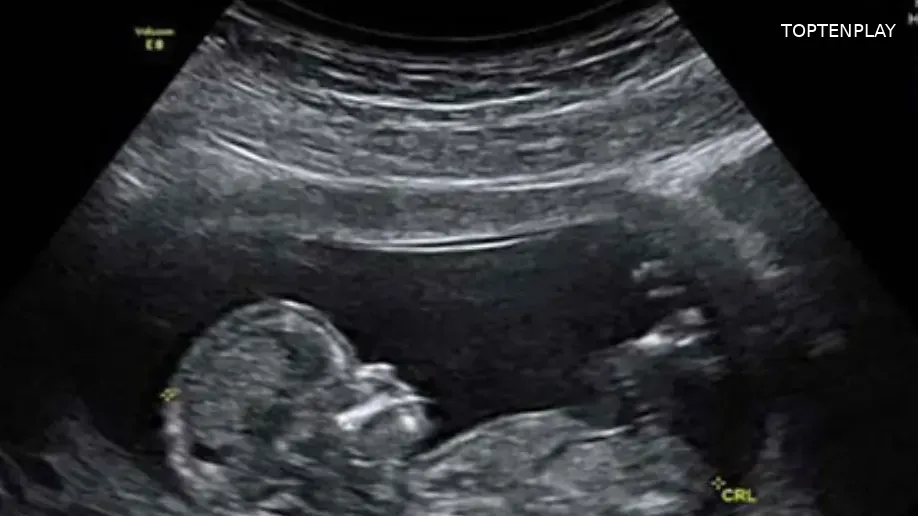 Image d'illustration © TopTenPlay EN