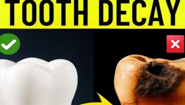 At 47, dentists discover what she’s been doing 3 times a week with guava leaves At 47, dentists discover what she’s been doing 3 times a week with guava leaves