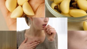 antifungal properties of garlic beetroot digestion issues cloves and blood thinners cloves for immunity garlic honey glaze Herbal Health natural remedies 