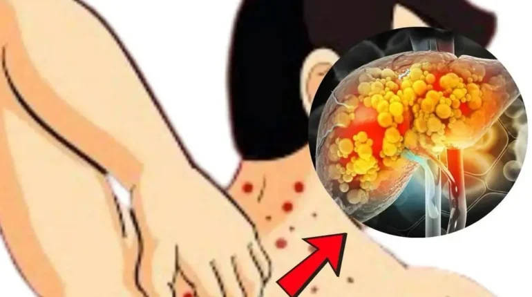 alkaline diet cancer allergy prevention Breathing Exercises foods bad for liver health Health Habits healthy lifestyle non-alcoholic fatty liver disease 