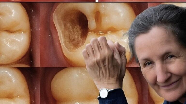 Cavity Prevention Diet Changes herbal oral hygiene Mineral-Rich Foods natural health tonic Tooth Enamel 