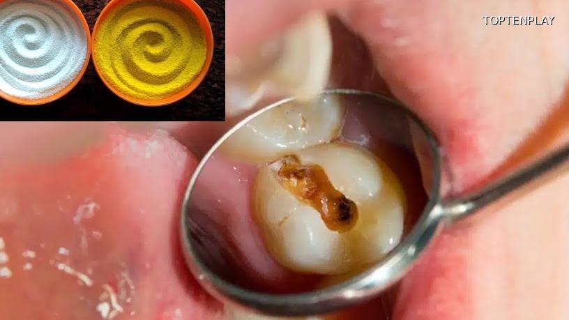 Image d'illustration © TopTenPlay EN