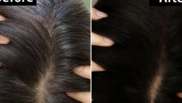 aloe vera hair care aloe vera hair mask Ayurveda Grey Hair Hair Health Herbal Remedies Natural Hair Color 