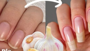 Garlic and Nail Growth: How Sulfur and Allicin Strengthen Keratin in 48 Hours Garlic and Nail Growth: How Sulfur and Allicin Strengthen Keratin in 48 Hours
