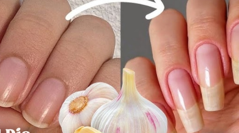 antifungal properties of garlic arthritis nail care tool Beauty Tips DIY Beauty Hair and Nails Nail Growth natural remedies 