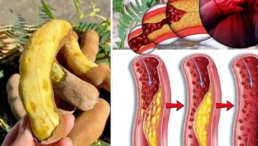 beetroot digestion issues bone health immune system and brain Skin Health Tamarind Weight Management Women's Health 