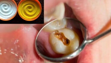 Baking Soda dental care tips garlic home remedies ginger teeth whitening herbal oral hygiene natural remedies turmeric 
