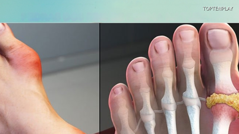 Image d'illustration © TopTenPlay EN