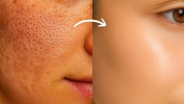 Porcelain Skin: How Clove Ice Tightens Pores and Reduces Redness in Under 3 Minutes