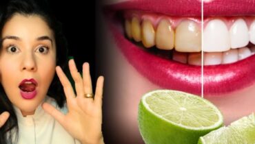 dental care tips garlic home remedies ginger teeth whitening herbal oral hygiene natural remedies Plaque Removal 