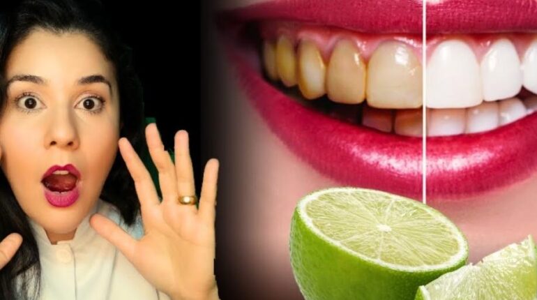 dental care tips garlic home remedies ginger teeth whitening herbal oral hygiene natural remedies Plaque Removal 