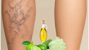 “I Do This 3-4 Times a Week”: Grandma’s Simple Recipe for Heavy, Tired Legs “I Do This 3-4 Times a Week”: Grandma’s Simple Recipe for Heavy, Tired Legs