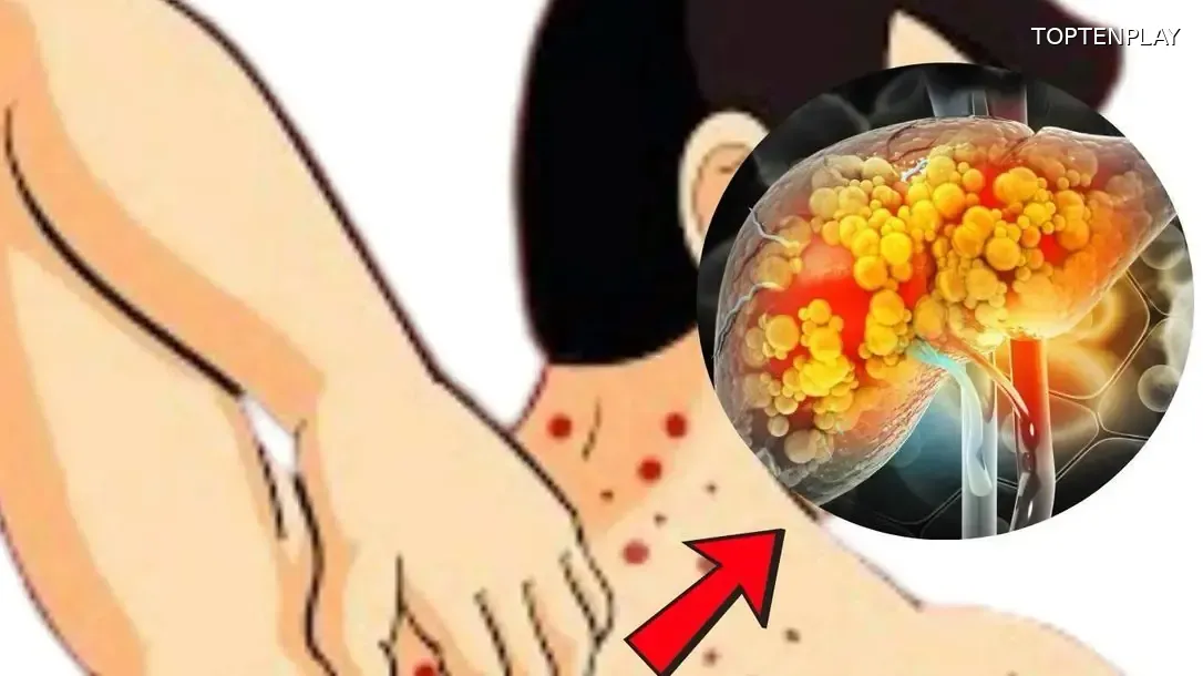 Image d'illustration © TopTenPlay EN