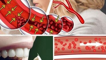 allicin health effects antifungal properties of garlic banana vinegar health benefits beetroot nutrition Cooking Tips natural remedies 