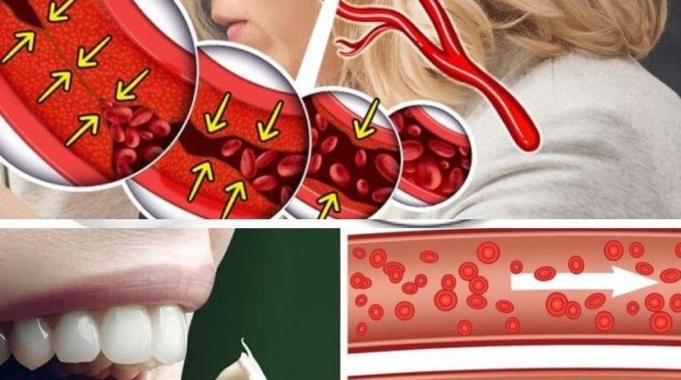 allicin health effects antifungal properties of garlic banana vinegar health benefits beetroot nutrition Cooking Tips natural remedies 