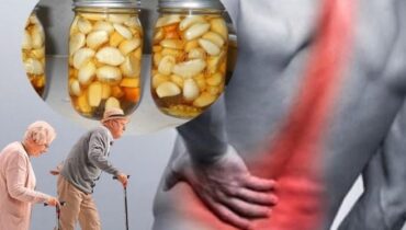 Natural Remedies for Leg Pain and Varicose Veins: How Garlic Oil and Epsom Salt Baths Improve Circulation Natural Remedies for Leg Pain and Varicose Veins: How Garlic Oil and Epsom Salt Baths Improve Circulation