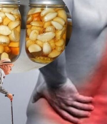 Natural Remedies for Leg Pain and Varicose Veins: How Garlic Oil and Epsom Salt Baths Improve Circulation