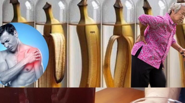 aloe vera hair care avoid extreme detox Banana Peels Home Care Kalanchoe skin care natural remedies Plant Fertilizer 