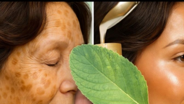 Skin Aging: How Traditional Plant Leaf Remedies Support Elasticity and Reduce Pigmentation Naturally
