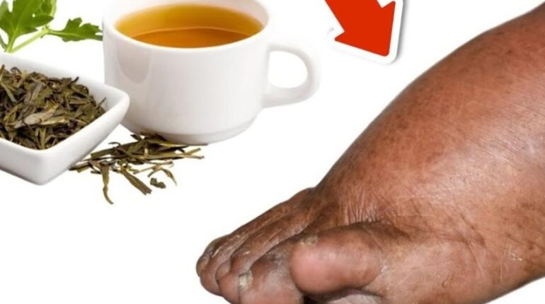 Ankles Swelling blood circulation herbal teas for digestion natural remedies Parsley Tea Swollen Legs Water Retention 