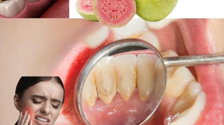 cloves for oral health dental care tips garlic home remedies guava leaves antibacterial benefits Herbal Medicine natural remedies 