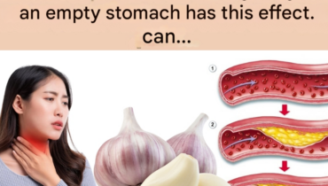 antifungal properties of garlic banana vinegar health benefits bedroom energy flow beetroot digestion issues cardiac wellness cloves for immunity natural remedies 