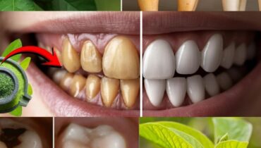 dental health sugar risks Fresh Breath guava leaves antibacterial benefits herbal oral hygiene natural gum care natural remedies 