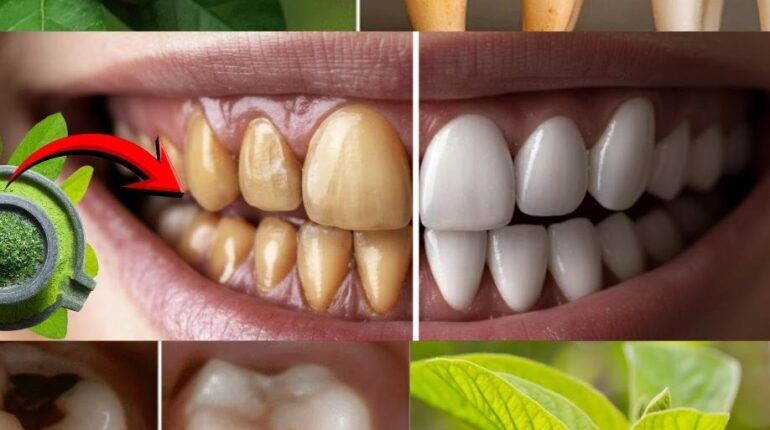 dental health sugar risks Fresh Breath guava leaves antibacterial benefits herbal oral hygiene natural gum care natural remedies 