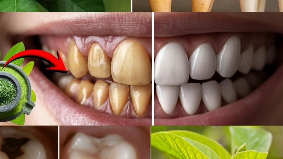 Guava Leaves for Dental Health: 3 Traditional Methods That Support Gum Care and Fresh Breath