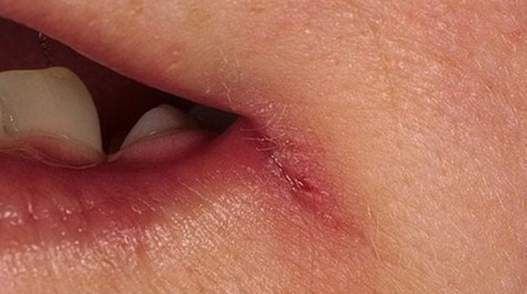 Advocate Health alkaline diet cancer beetroot nutrition Body Symptoms Deficiencies Minerals vitamins 