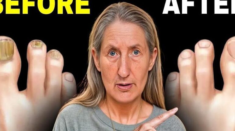 antifungal properties of garlic car odor removal with salt garlic home remedies lemon salt toenail fungus remedy nail health natural treatments 