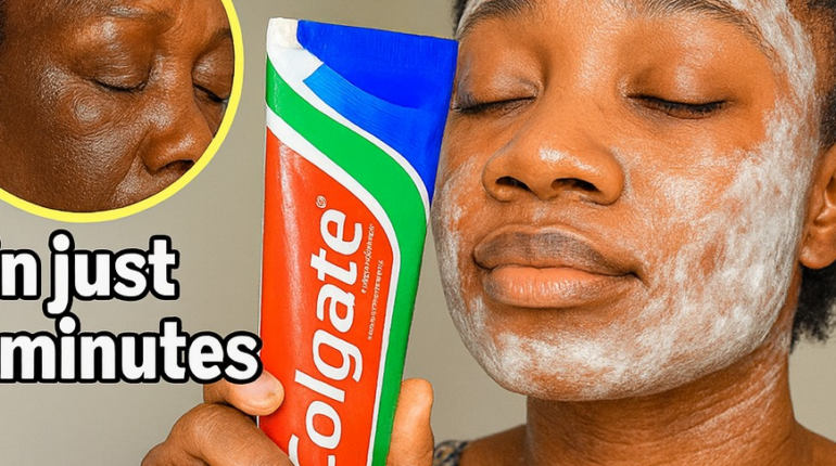 Acne treatment baking soda skincare Beauty Tips garlic home remedies natural skincare treatment Skin Health 