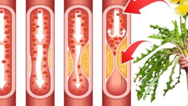 beetroot digestion issues bloating relief tips Dandelion Root herbal teas for digestion Liver Function natural remedies 