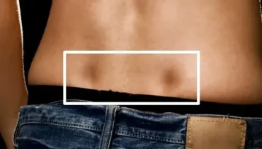 The Science Behind Venus Dimples: What These Lower Back Indentations Reveal About Your Genetics and Circulation The Science Behind Venus Dimples: What These Lower Back Indentations Reveal About Your Genetics and Circulation