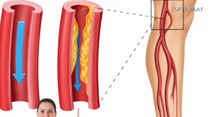 Image d'illustration © TopTenPlay EN