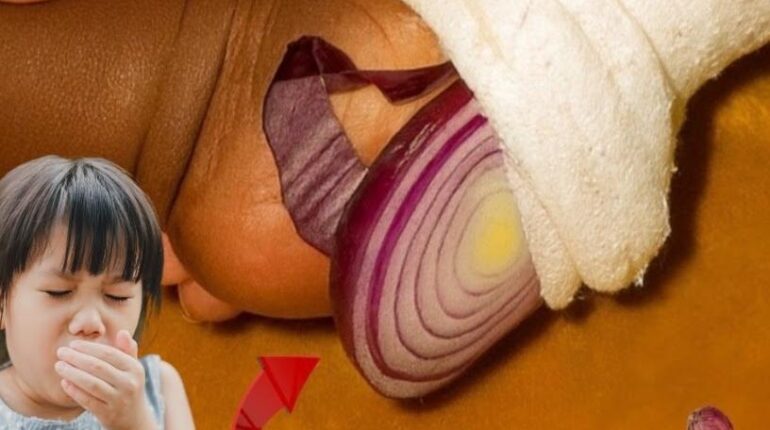 and horseradish. They can help ease flu symptoms like congestion and cough cough relief garlic home remedies natural health tonic natural sleep aid Quercetin Sulfur Compounds 