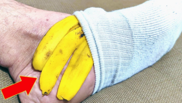 At 47, She Does This With Banana Peels 3 Times a Week on Her Feet At 47, She Does This With Banana Peels 3 Times a Week on Her Feet
