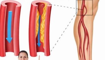 Neem Leaves: How This Ancient Plant Supports Blood Sugar Balance, Circulation, and Inflammation Control