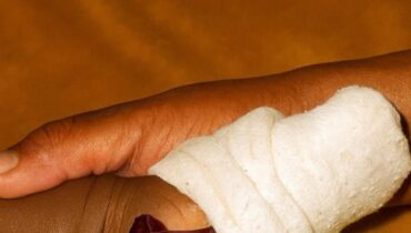 Red onion in your sock at night: the ancestral remedy that clears congestion through sulfur compounds and quercetin Red onion in your sock at night: the ancestral remedy that clears congestion through sulfur compounds and quercetin