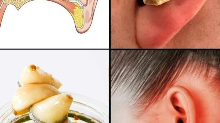 allicin health effects antifungal and antibacterial oil ear health tips Ear Infections Garlic Oil Homeopathic natural remedies 