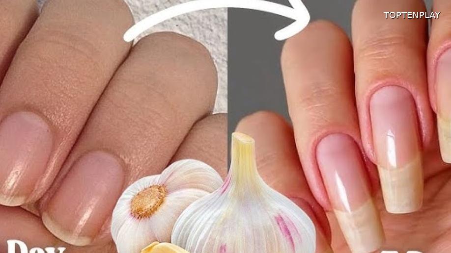 Image d'illustration © TopTenPlay EN