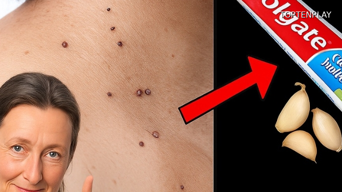 Image d'illustration © TopTenPlay EN