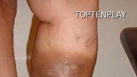 Image d'illustration © TopTenPlay EN