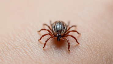 Powassan disease: this tick-borne infection kills 10% of patients and leaves neurological sequelae in half of survivors